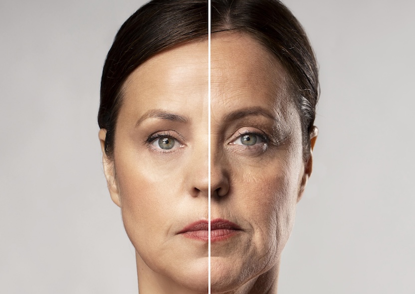 ameliyatsız yüz germe estetik operasyonu görseli