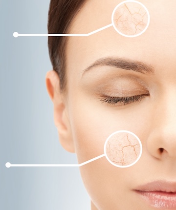 gözenek sıkılaştırma dikey görsel